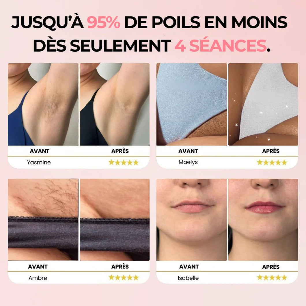 Lumière Douce IPL